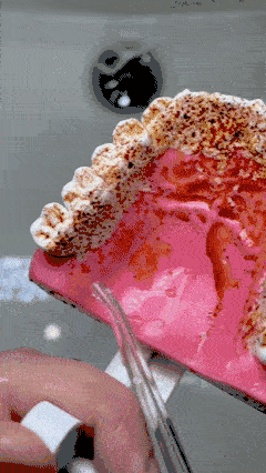 IrrigaClean irrigador dental